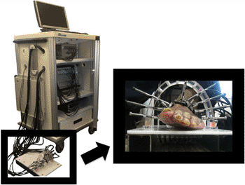 Image: A new technique called dynamic diffuse optical tomography imaging (DDOT) is intended to provide earlier diagnosis in patients with peripheral artery disease (Photo courtesy of Columbia University).